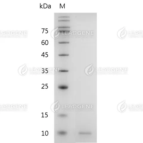 Human CXCL5, His Tag, E. coli