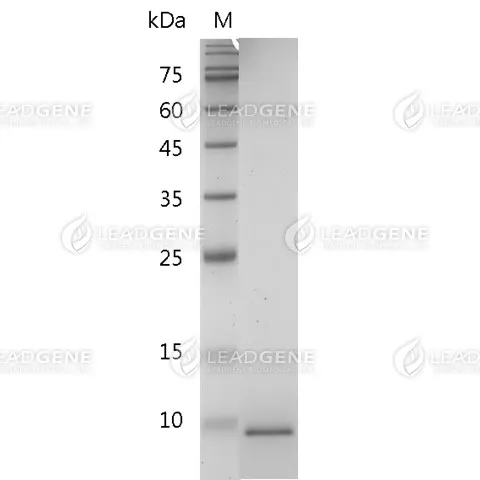 Human CXCL6, His Tag, E. coli