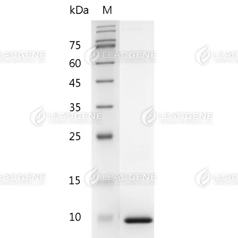SDS-PAGE analysis of recombinant human CXCL7.