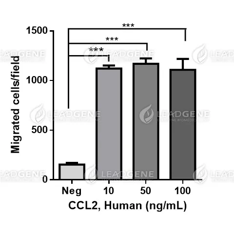 Human CCL2, His Tag, E. coli