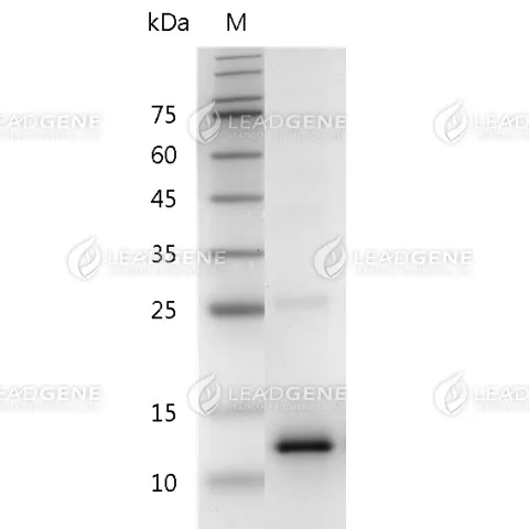 Human CCL2, His Tag, E. coli