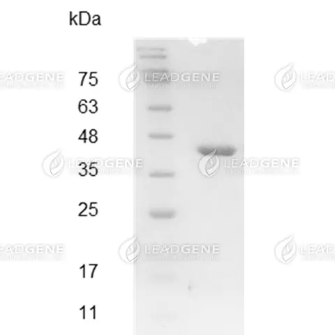 Human OGG1, His Tag, E. coli