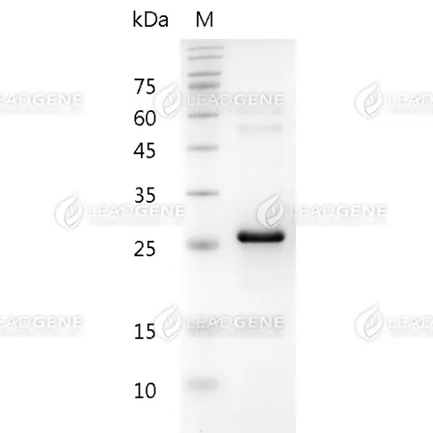 Human Noggin, His Tag, E. coli
