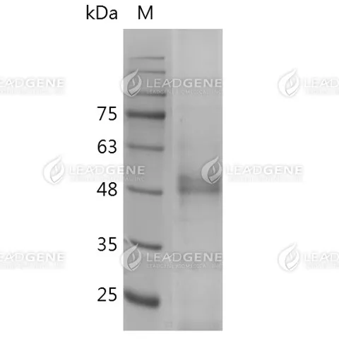 Human HMGB1 (C23A, C45A, C106A), His-SUMO Tag, HEK293