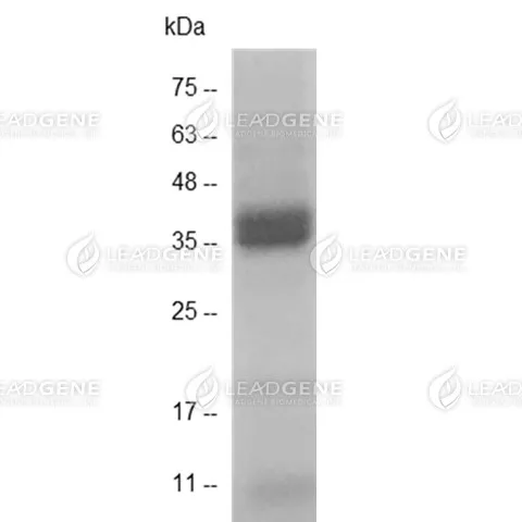 Human HMGB2, His-SUMO Tag, HEK293