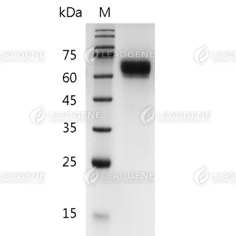 Human IL-12 (p70), His Tag, HEK293