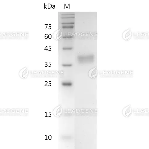 SARS-CoV-2 ORF8 Protein (aa 16-121), His-SUMO Tag, HEK293