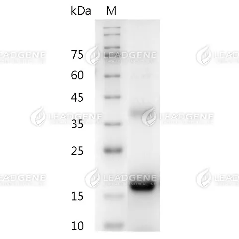 Mouse M-CSF, His Tag, E. coli