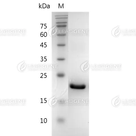 Mouse G-CSF, His Tag, E. coli