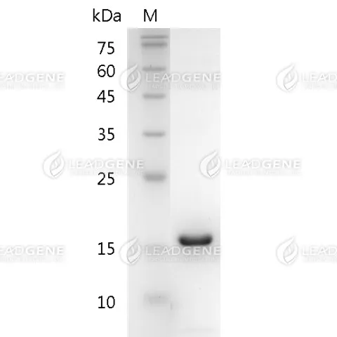 Mouse CXCL5, His Tag, E. coli