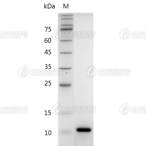 Mouse CXCL7 (aa 40-113), His Tag, E. coli