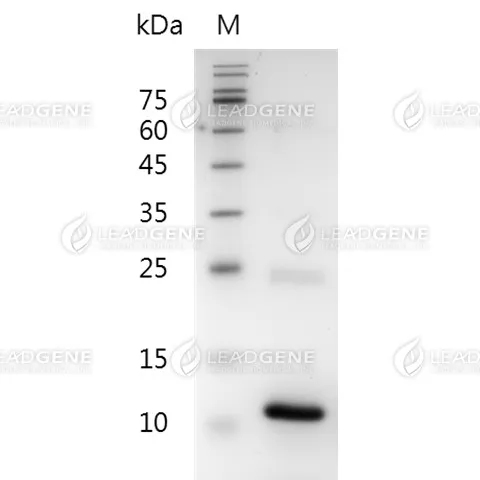 Mouse CXCL16, His Tag, E. coli