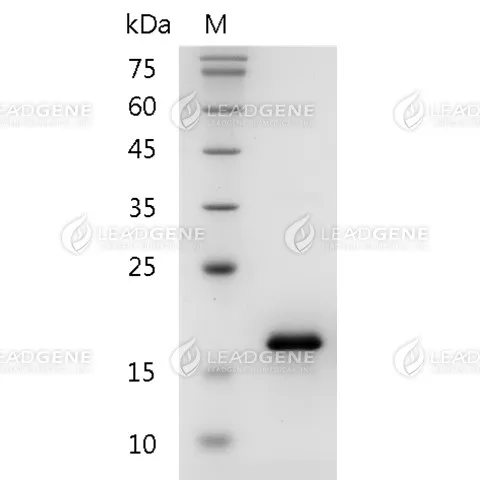 Mouse CCL2, His Tag, E. coli