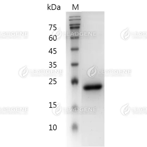 Mouse IL-6, His Tag, E. coli