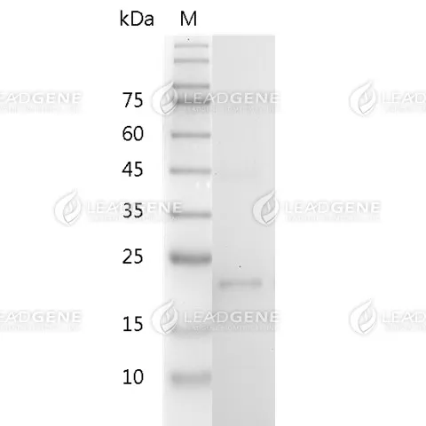 Mouse IL-12 (p35), His Tag, E. coli