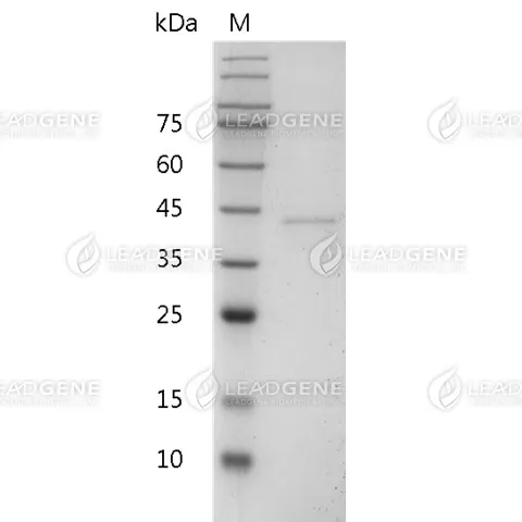Mouse IL-12 (p40), His Tag, E. coli