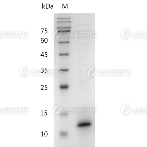 Mouse IL-15, His Tag, E. coli