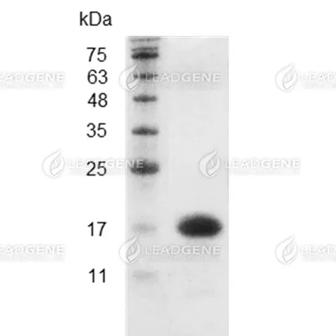 Mouse IL-16, His Tag, E. coli