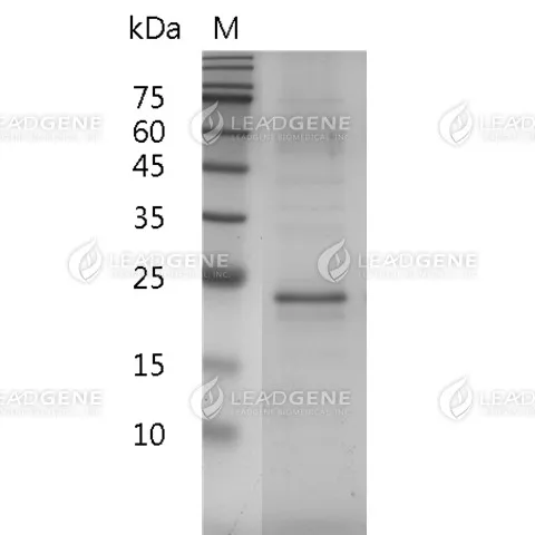 Mouse IL-17A, His Tag, E. coli