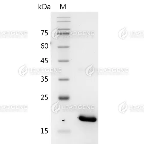Mouse IL-17B, His Tag, E. coli