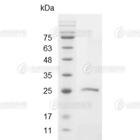 Mouse IL-17D, His Tag, E. coli