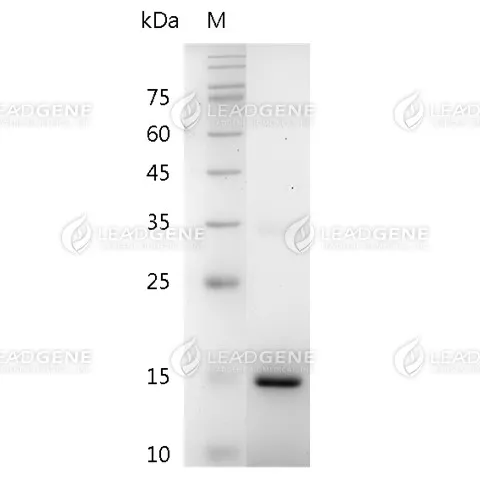 Mouse IL-20, His Tag, E. coli