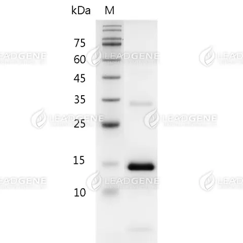 Mouse IL-21, His Tag, E. coli