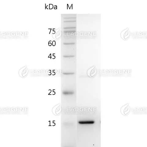 Mouse IL-24, His Tag, E. coli