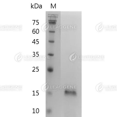 Mouse IL-25, His Tag, E. coli