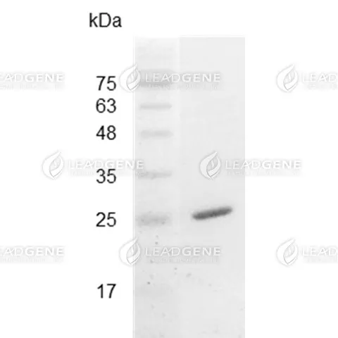 Mouse IL-30, His Tag, E. coli