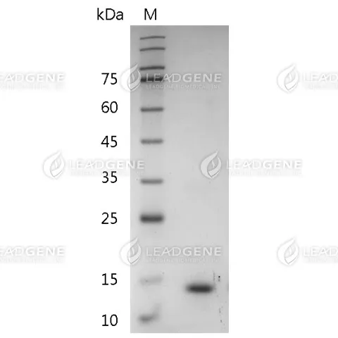 Mouse IL-31, His Tag, E. coli