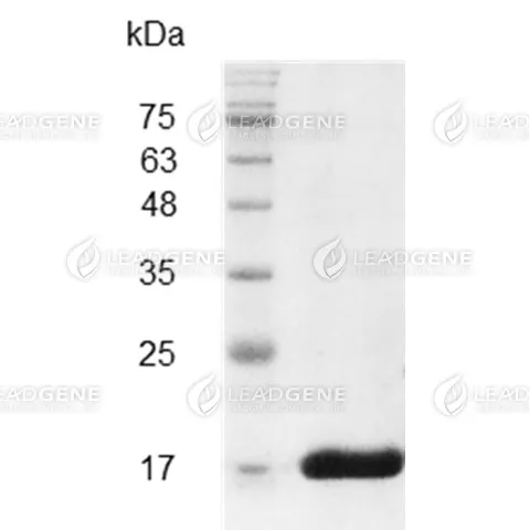 Mouse IL-36 Gamma, His Tag, E. coli