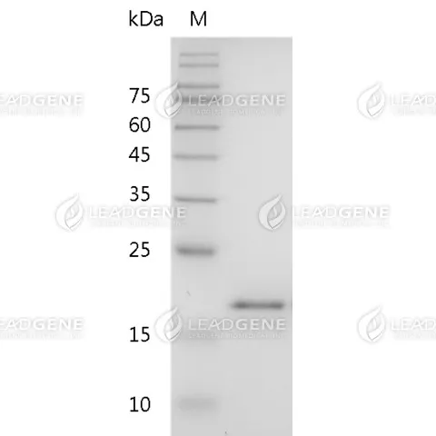 Mouse IL-36RA, His Tag, E. coli