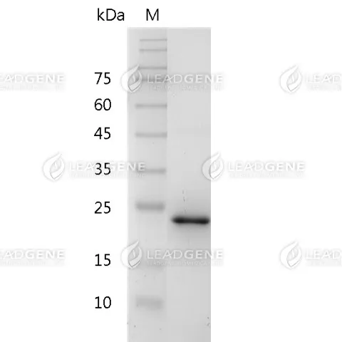 Mouse 4-1BBL, His Tag, E. coli