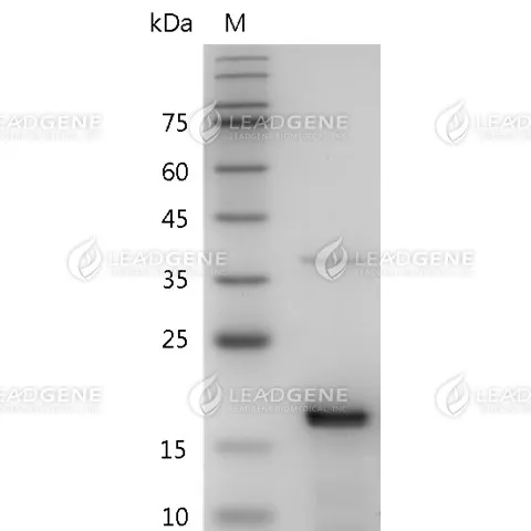 Mouse FGF-2, His Tag, E. coli