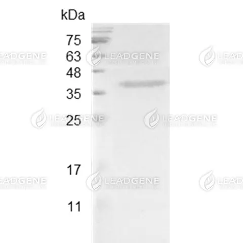 Mouse HDGF, His Tag, E. coli