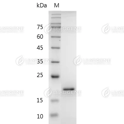 Mouse FasL, His Tag, E. coli