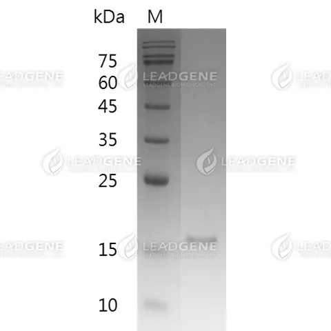 Mouse RANKL, His Tag, E. coli