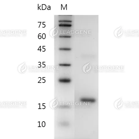 Mouse CDNF, His Tag, E. coli