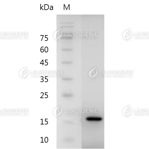 Mouse Midkine, His Tag, E. coli