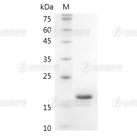 Swine GM-CSF, His Tag, E. coli